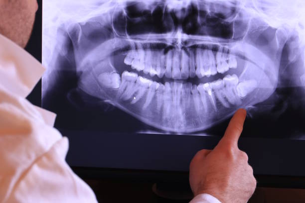 Best Mobile Emergency Dentist in Chesterton, IN