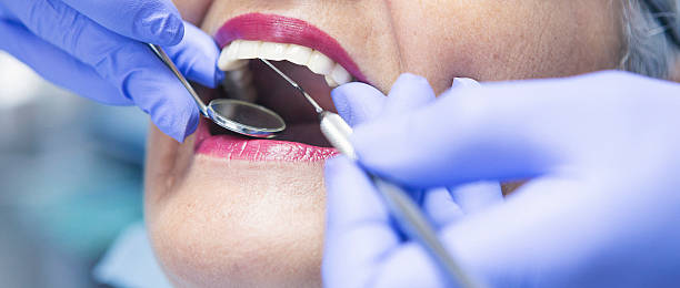 Best Emergency Dentist for Knocked-Out Tooth in Chesterton, IN